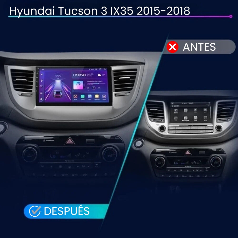 Radio Android Auto Carplay Hyundai Tucson 3 IX35 2015-2018